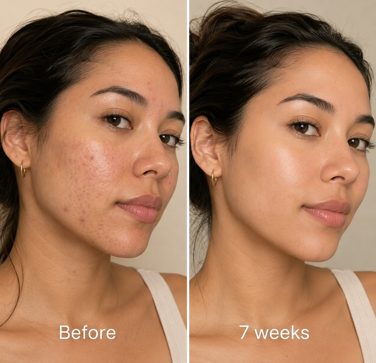 Aliara Acne Repair Stick