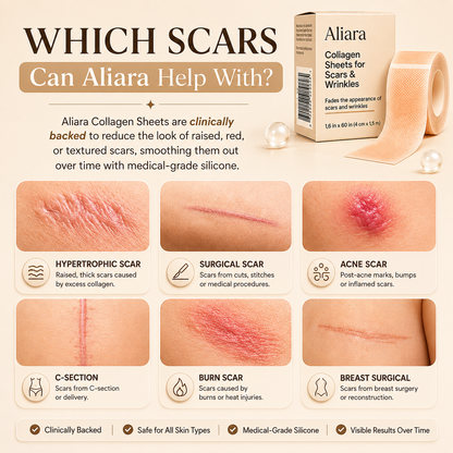 Aliara Benefit